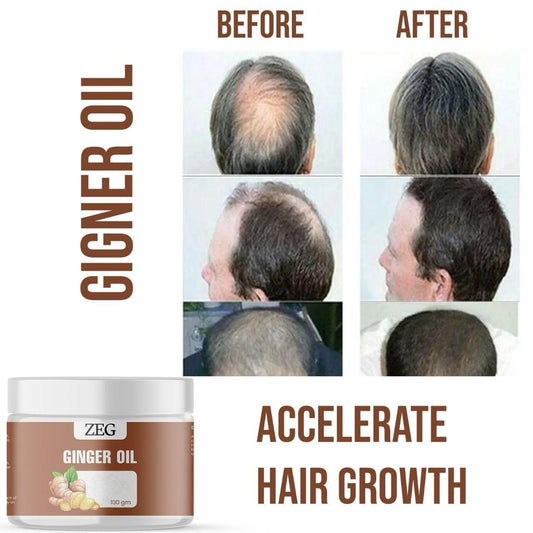 ZEG GINGER OIL 100GM 100% Natural Multipurpose Oil for Hair, Skin & Body (Pack of 2)